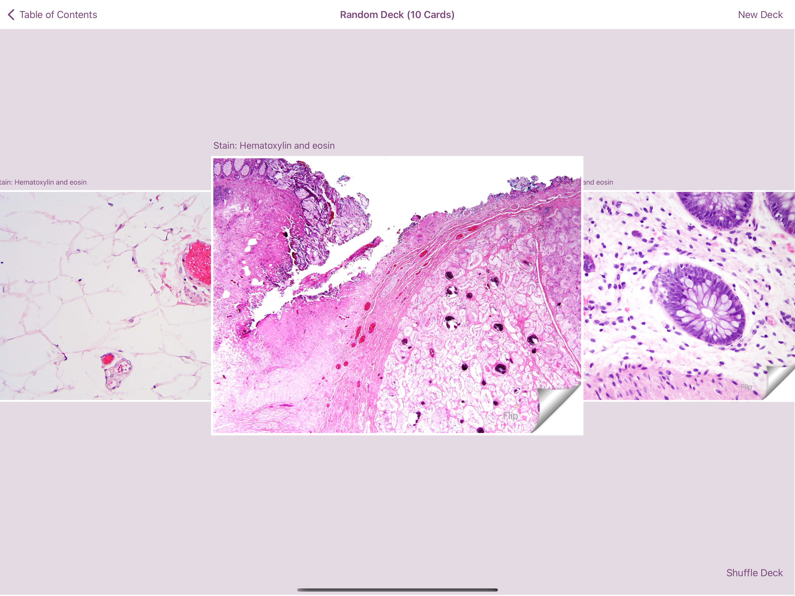 Colonic Pathology