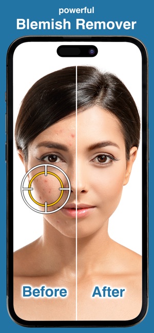 Blemish Remover Photo Tool on the App Store