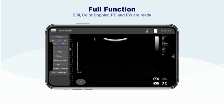 SONO USG screenshot 2