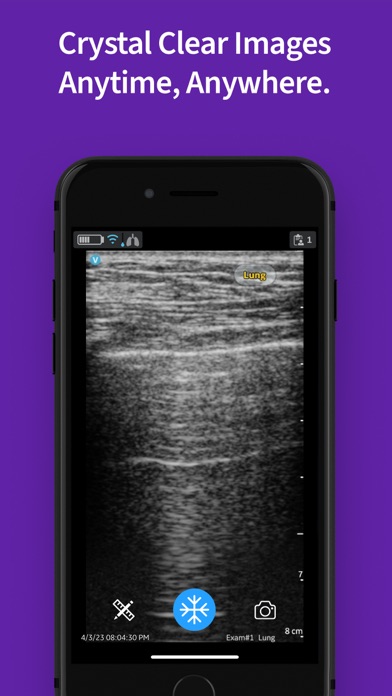 Vscan Air VET Ultrasound Screenshot