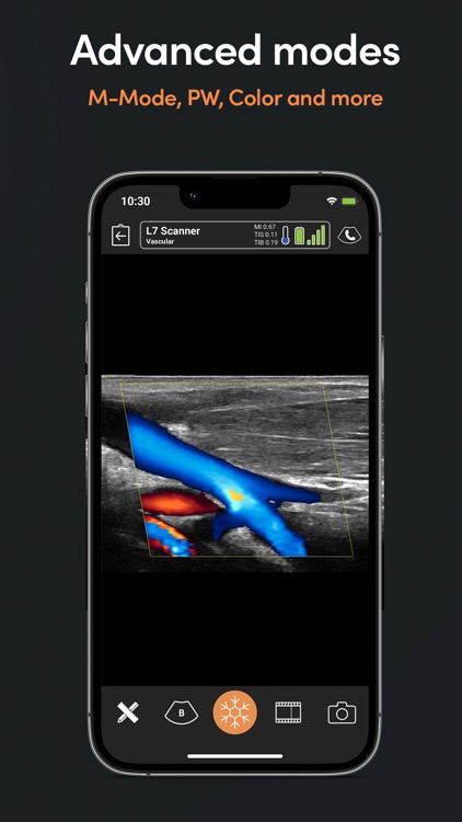 Clarius Ultrasound App screenshot-3