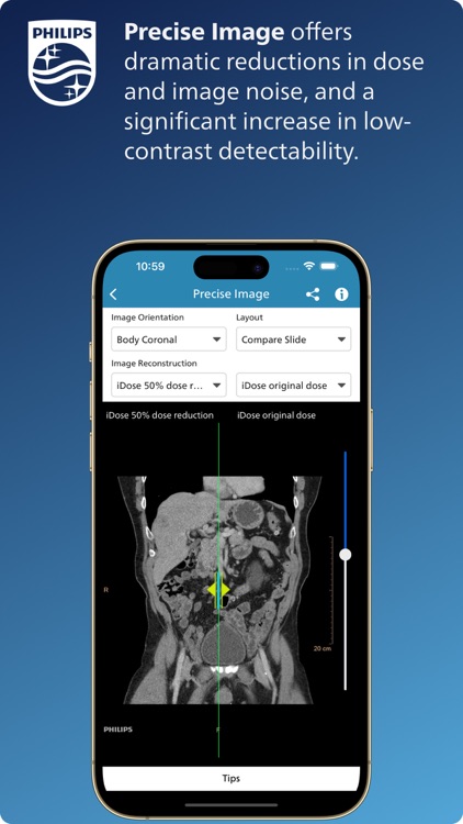 Philips CT Learning screenshot-5