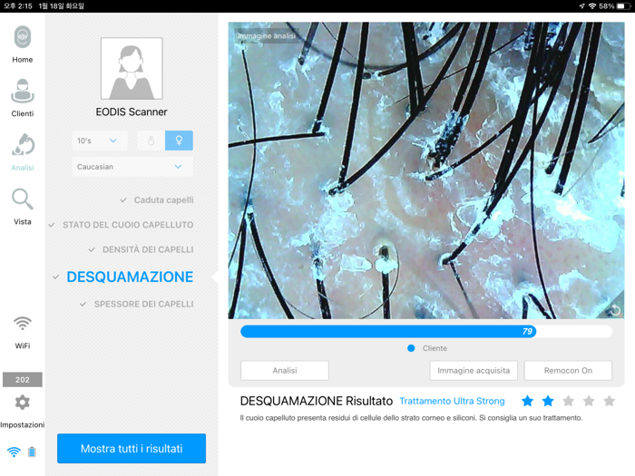 EODIS Hair and Scalp Scanner