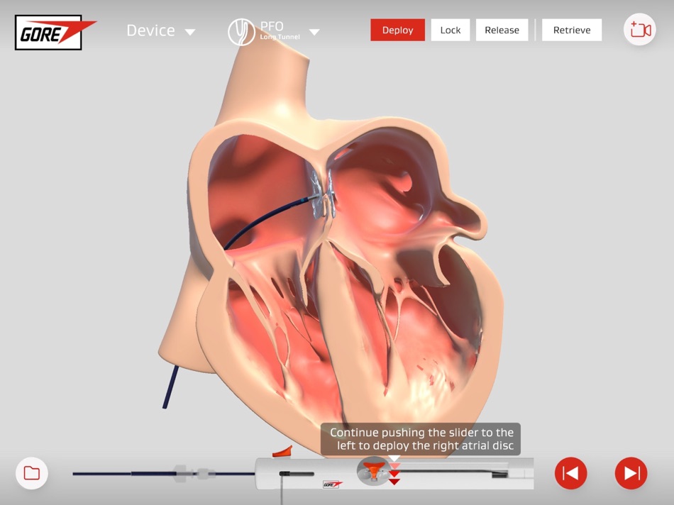 #1. Gore Cardioform (iOS) 由: W. L. Gore & Associates, Inc.