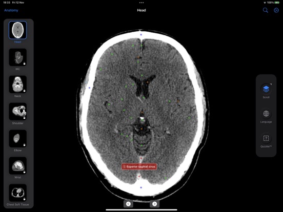 CT Anatomyのおすすめ画像2