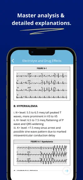 Game screenshot ECG EKG Interpretation Mastery hack
