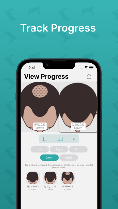 Hairly: Fight Hair Loss Screenshot