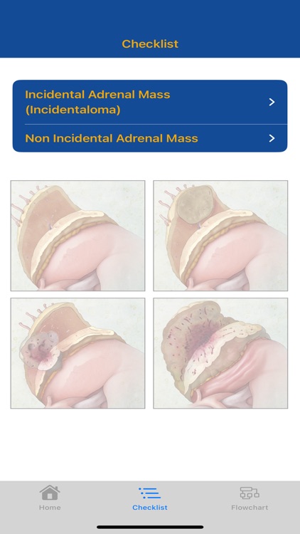 CTisus Adrenal Mass Checklist