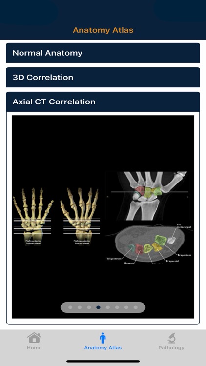 CTisus: CT of the Hand & Wrist screenshot-5