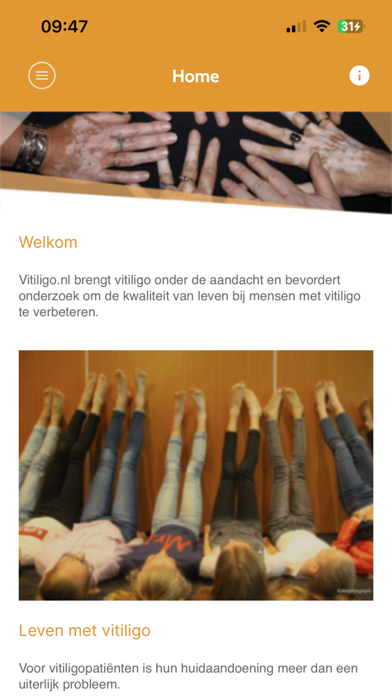 Vitiligo.nl Screenshot