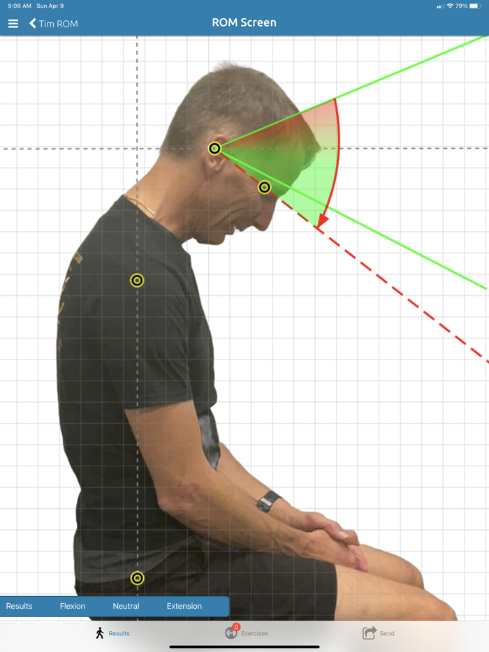 PostureScreen Mobile