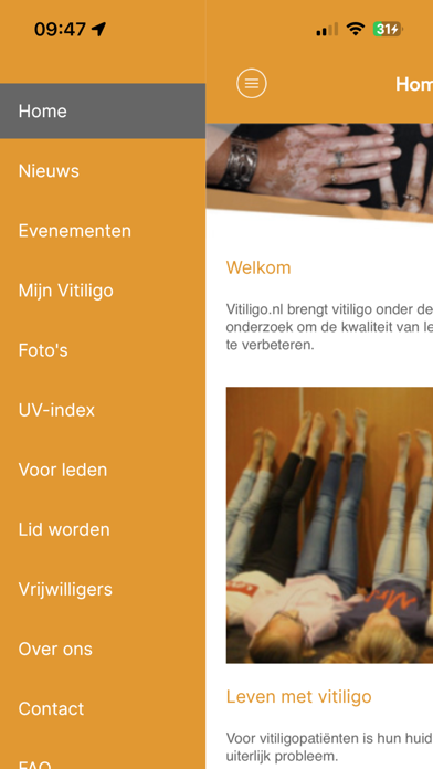 Vitiligo.nl Screenshot
