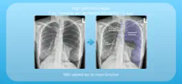 Game screenshot Chest X-rays hack