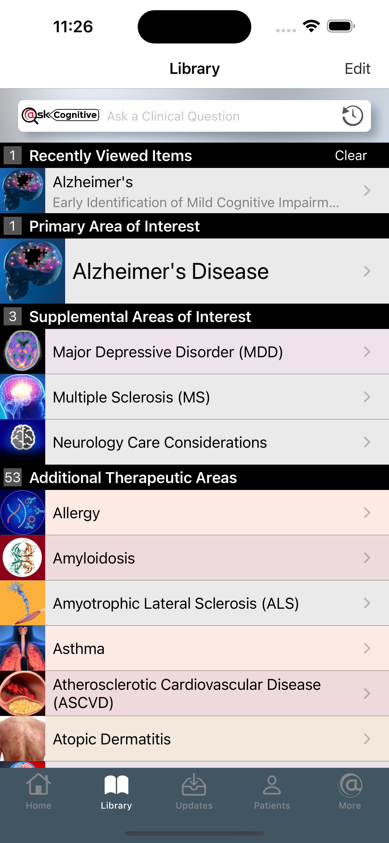Alzheimer's