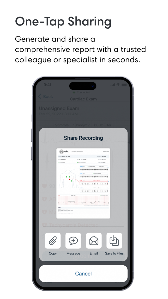 Eko Digital Stethoscope  ECG