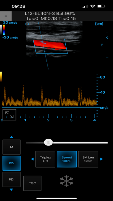 Ultrasound Touch Screenshot