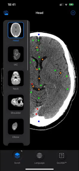 Game screenshot CT Anatomy apk