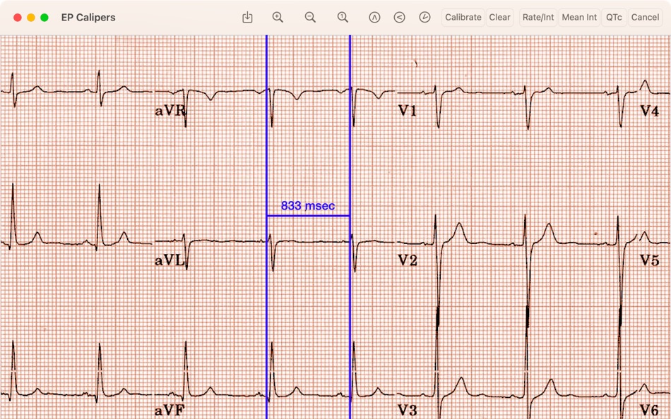 #1. EP Calipers (macOS) Podle: EP Studios