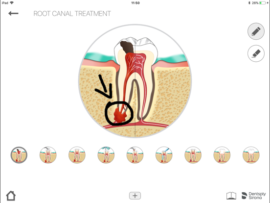 Endo IQ® App - Japanのおすすめ画像7