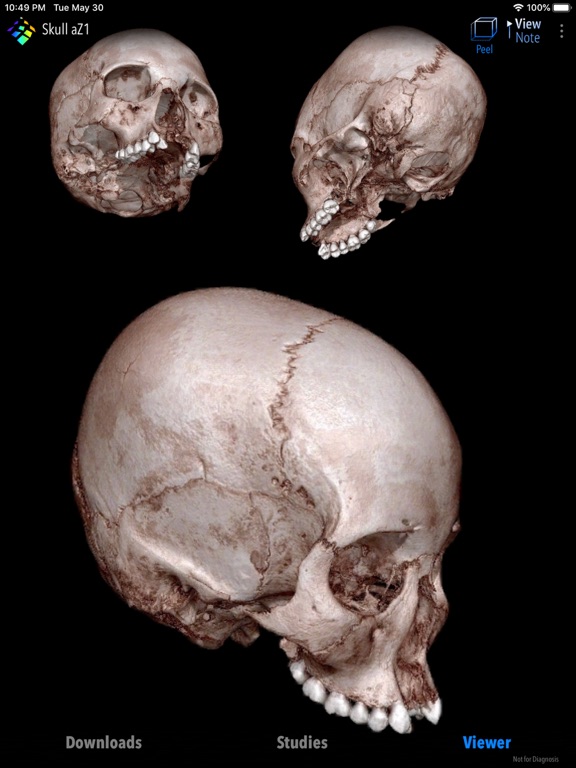 Screenshot #4 pour MedVizi™ CT-MRI Viewer
