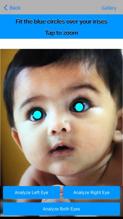 Eye Color Analyzer - UNiKA