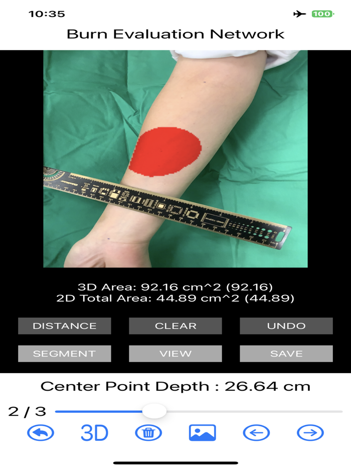 Burn Evaluation Network