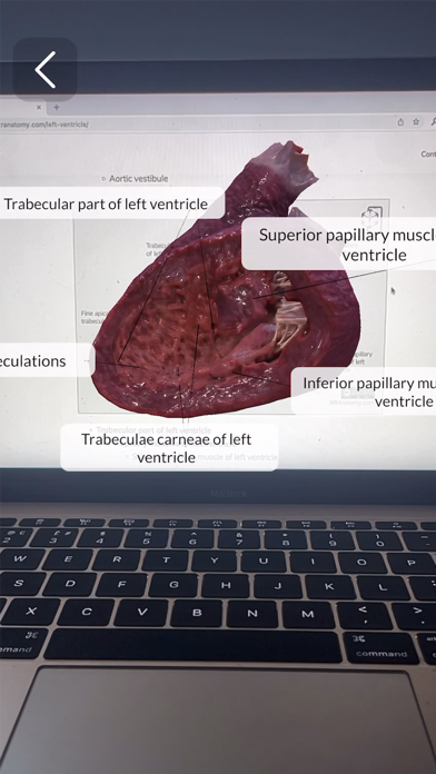 XR Anatomyのおすすめ画像5