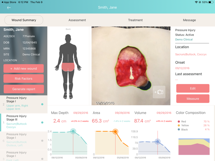 eKare inSight Research