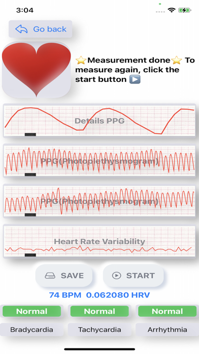 cardiac diagnosis(paid) Screenshot