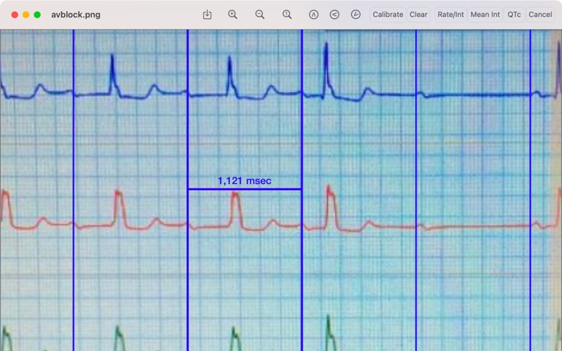 ep calipers iphone screenshot 4