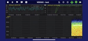 VEEGix EEG screenshot #3 for iPhone