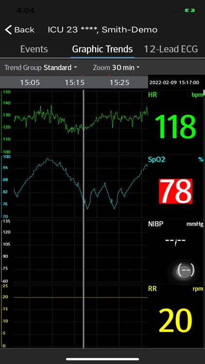 Mindray Mobile Viewer II screenshot-5