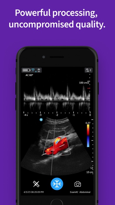 Vscan Air Wireless Ultrasound Screenshot