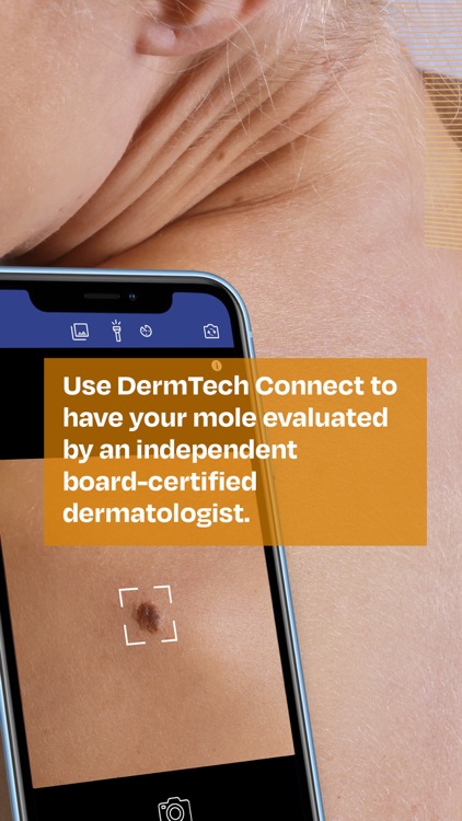 DermTech Connect