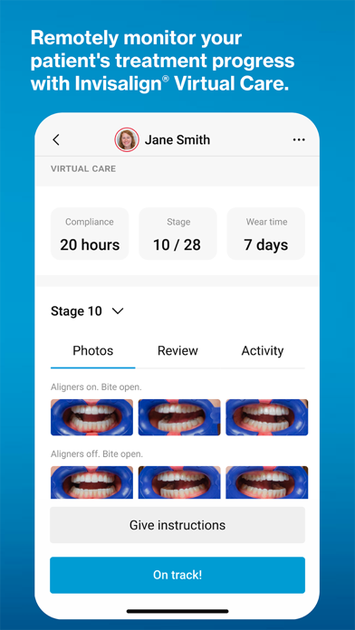 Invisalign Practice App Screenshot