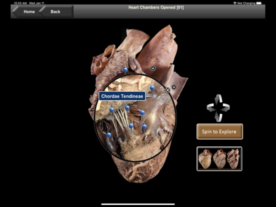 UA Heart Anatomyのおすすめ画像5