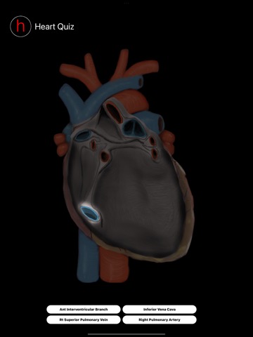 Human Heart Anatomy Quizのおすすめ画像7