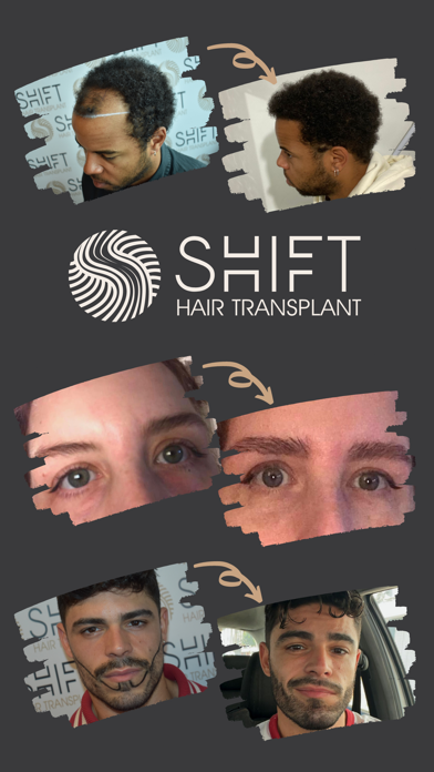 SHIFT Hair Transplant Screenshot