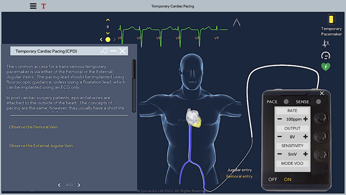 Temporary Cardiac Pacing