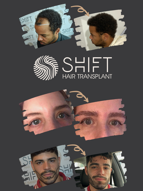 Screenshot #4 pour SHIFT Hair Transplant