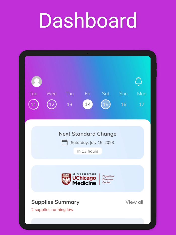 OstoBuddy Ostomy Companion