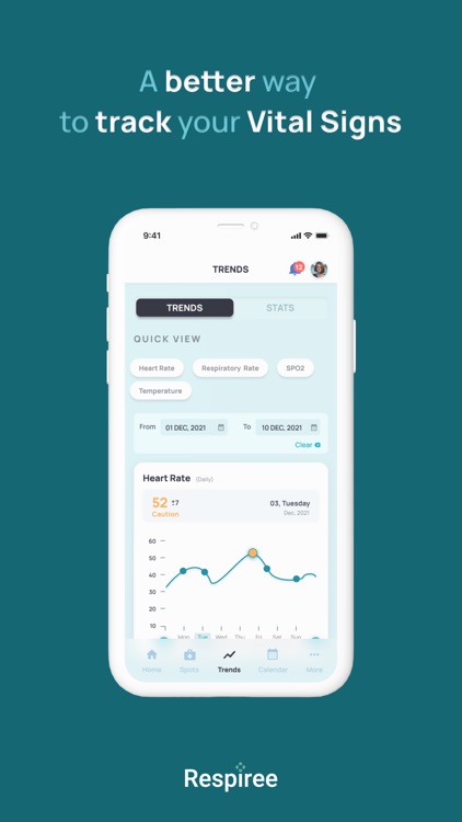 Respiree Mobile - AU
