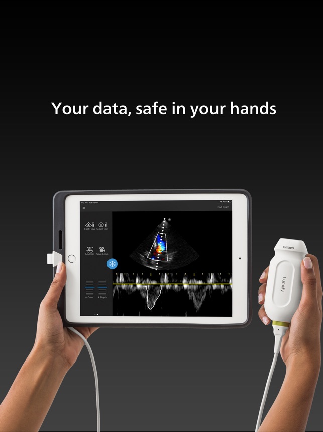 Lumify Handheld Ultrasound on the App Store