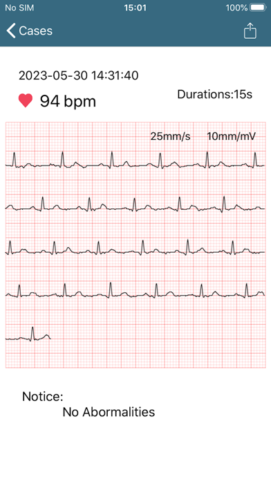 NuvoMed EKG Screenshot