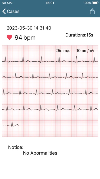 NuvoMed EKG