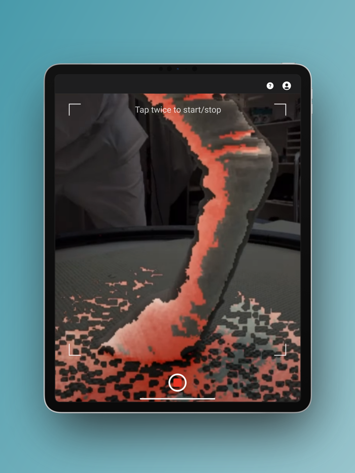 Scandi Orthopedic 3D Scanner