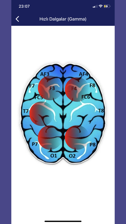 #9. Auto Train Brain (iOS) 由: HMS Health Mobile Software