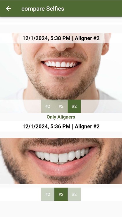 Only Aligners screenshot-6