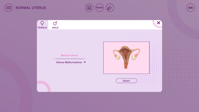 Screenshot #1 pour U-Theramex