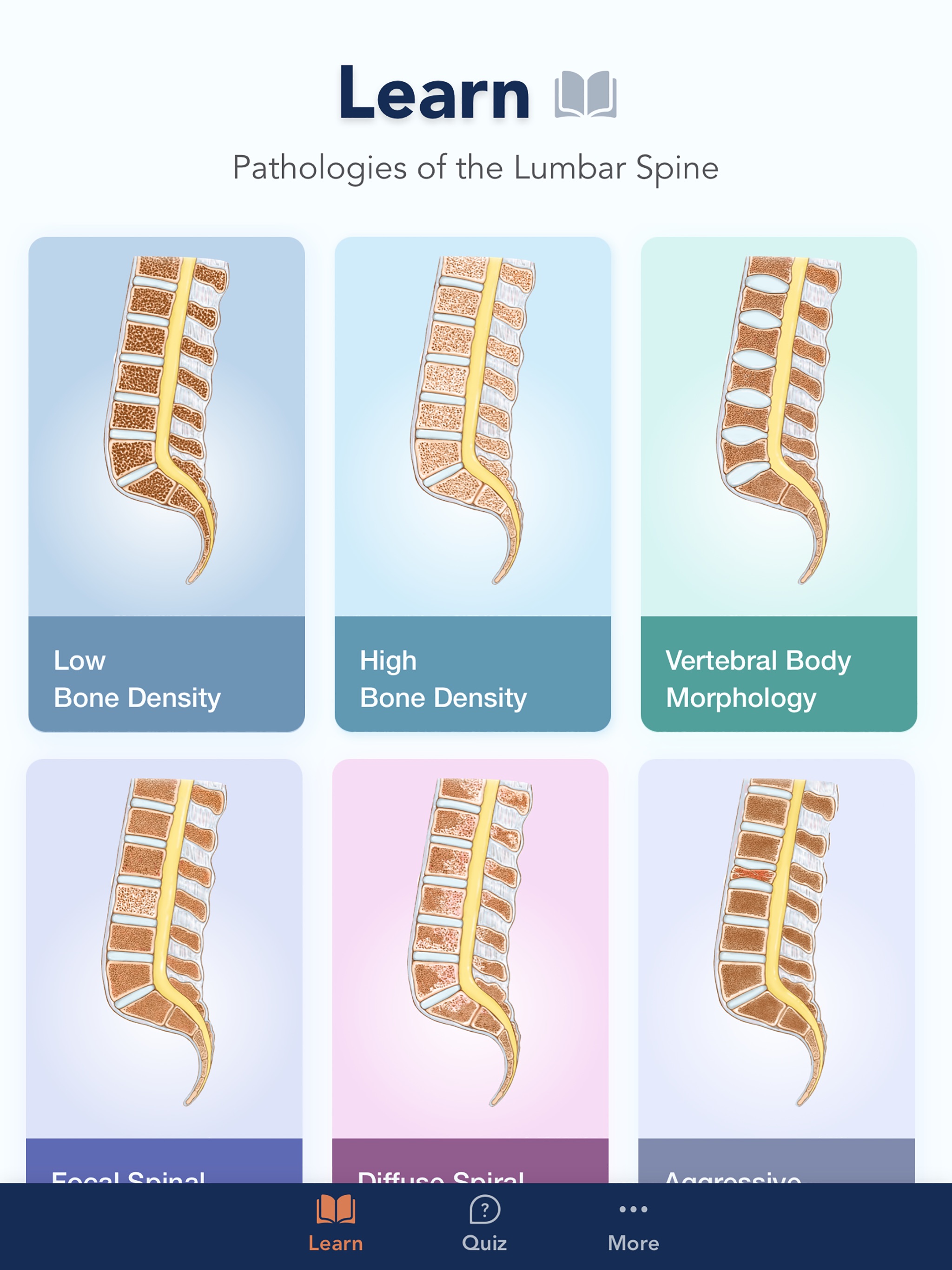 CTisus L-Spine Pathologyのおすすめ画像1